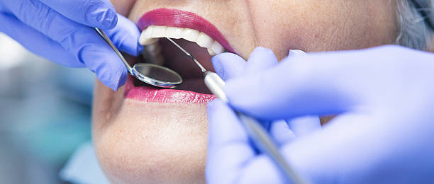Best Emergency Dental Extractions in Jamestown, TN
